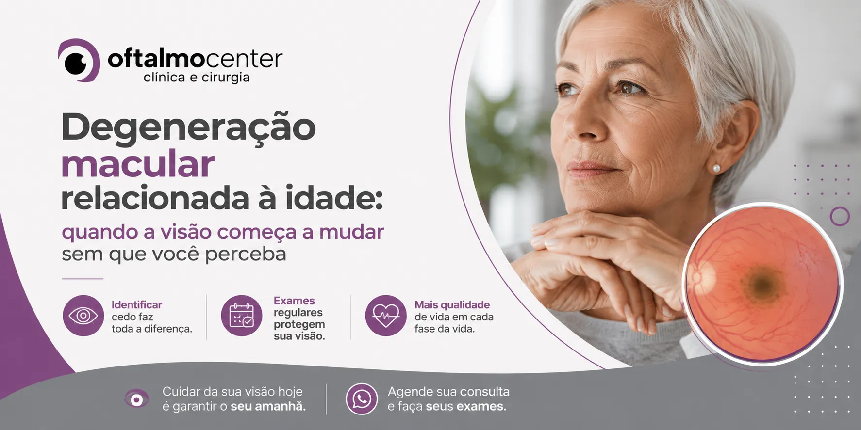 Degeneração macular relacionada à idade